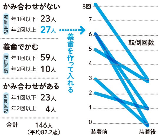かみ合わせを調整した義歯をつけると転倒回数が減る