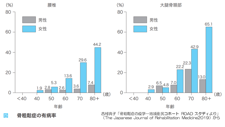 骨粗鬆症の有病率