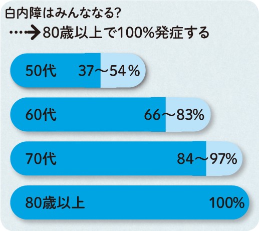 白内障の原因のほとんどは加齢で、早いと40代から発症し、年齢が上がるにつれ有病率も上がります。80代では100%、つまり、すべての人にみられます