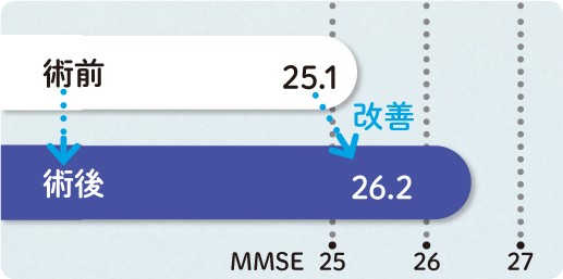 筑波大学では、白内障の手術を受けた55~93歳の88人を対象に、手術前と手術2カ月後に「見えやすさ」と「認知機能(MMSEの点数)」の変化について調査しました。その結果、手術後の視力改善によりものが見えやすくなり、認知機能の改善、うつ症状の改善、QOLの向上がみられました。