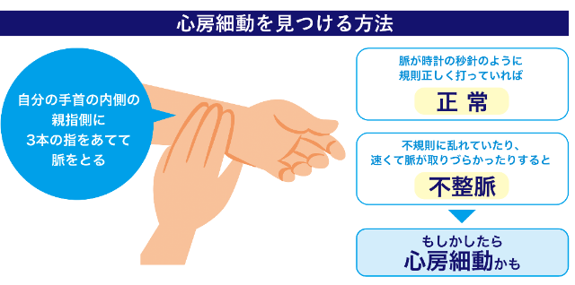心房細動を見つける方法640