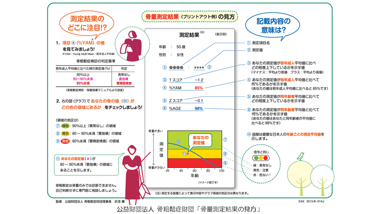 骨量測定結果の見方