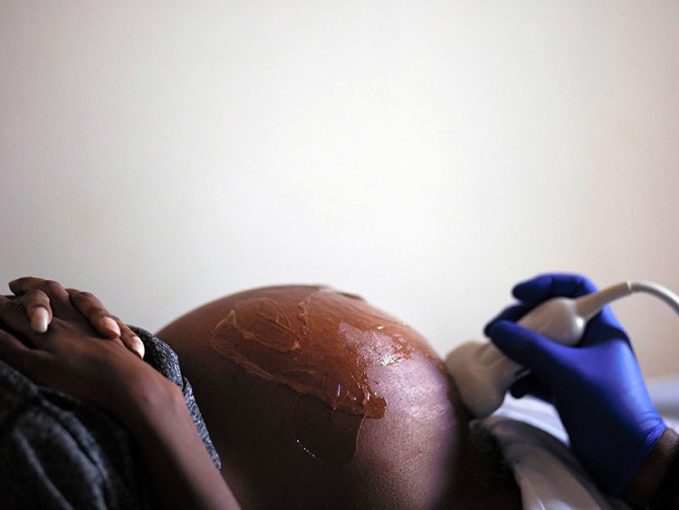 **EMBARGO: No electronic distribution, Web posting or street sales before Wednesday 12:01 a.m. ET Nov. 27, 2019. No exceptions for any reasons. EMBARGO set by source.** FILE -- A woman gets a sonogram in New York, Aug. 14, 2018. The rate of births fell again in 2018, according to new government data, extending a lengthy decline as women wait until they are older to have children. (Gabriella Angotti-Jones/The New York Times)