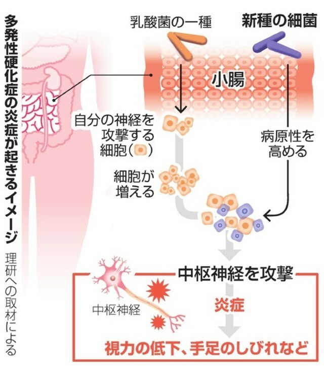 多発性硬化症と腸内細菌