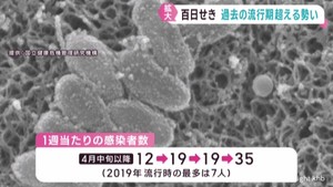 百日せき　宮城県でも過去の流行を超える勢いで感染者数が増加