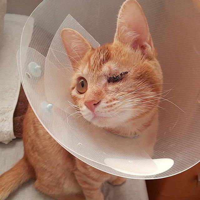 摘出手術後、抜糸する前のみちる。「エクステしているみたいだね」