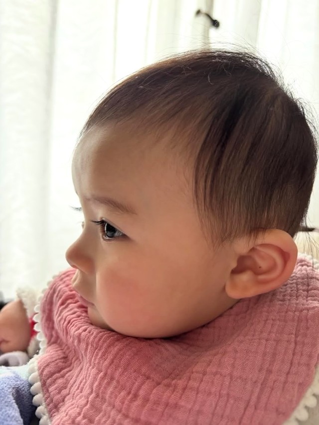 横顔から薄毛の様子がわかる娘さん／Narumiさん（@nrm2_1）提供