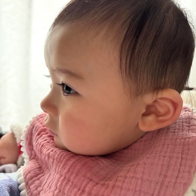 横顔から薄毛の様子がわかる娘さん／Narumiさん（@nrm2_1）提供