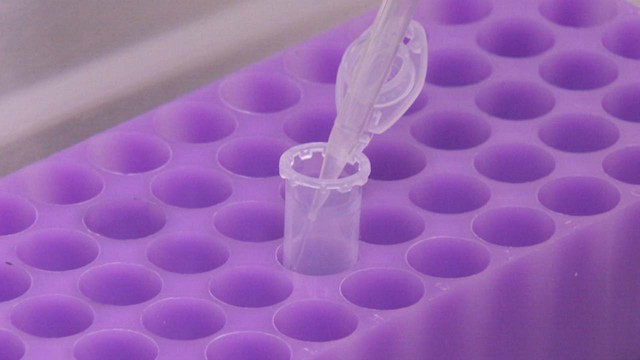 岡山県で新たに2935人が感染　 病床使用率は58.9%〈新型コロナ〉