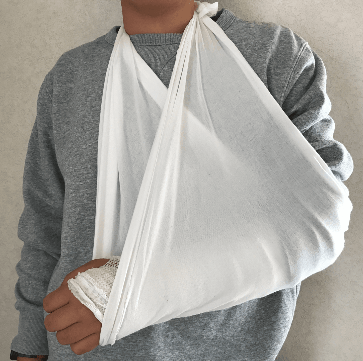 機械の故障による大けが…損害賠償されるのか　※画像はイメージです（gumitochocotocarrypan/photoAC）