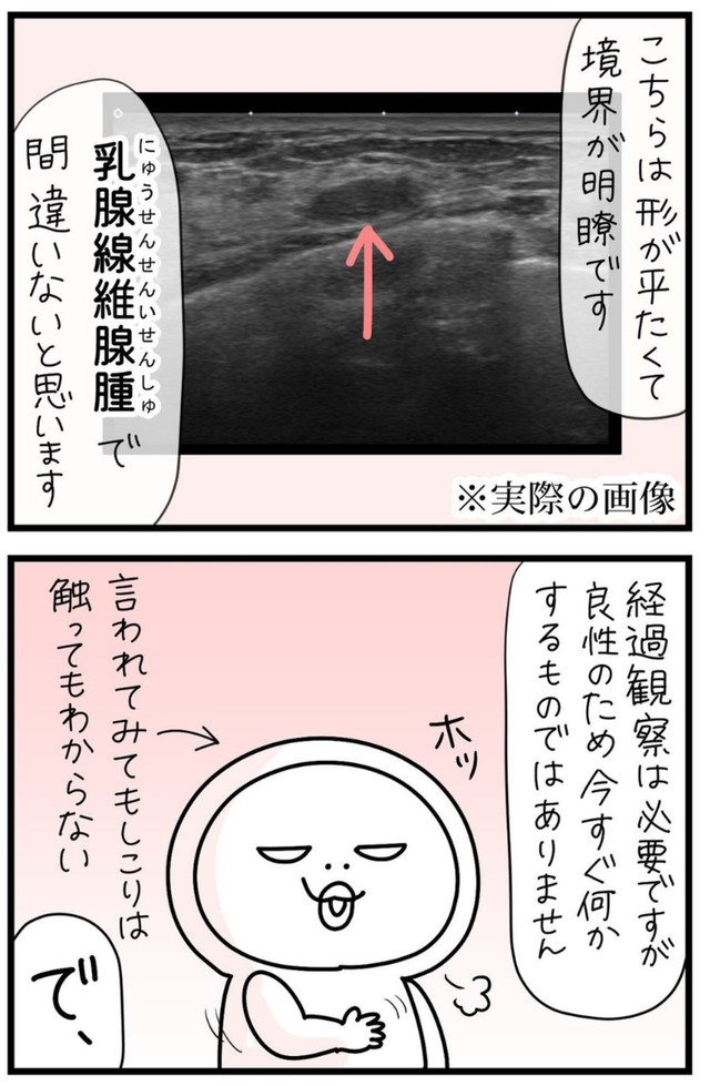 【漫画】『しろめちゃん・45歳・シンママ乳がん列伝』25（しろめちゃんさん提供）