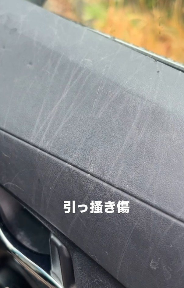 引っかき傷（「Melody’s mom」さん提供、Instagramよりキャプチャ撮影）