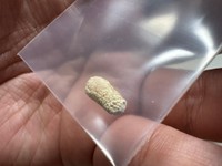 唾石は記念に袋に保管。