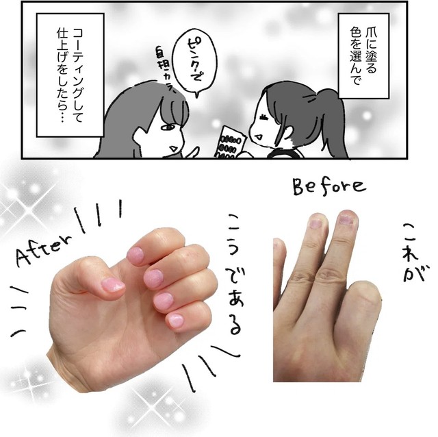 今まで悩んでいた深爪が…何ということでしょう！（みりこさん提供）