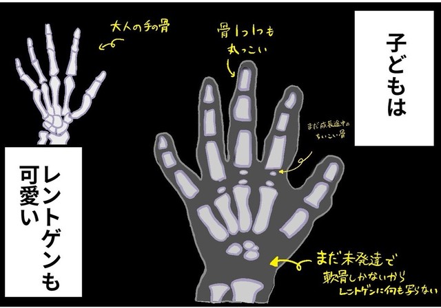 子どもは骨も可愛い（からばく社さん提供）
