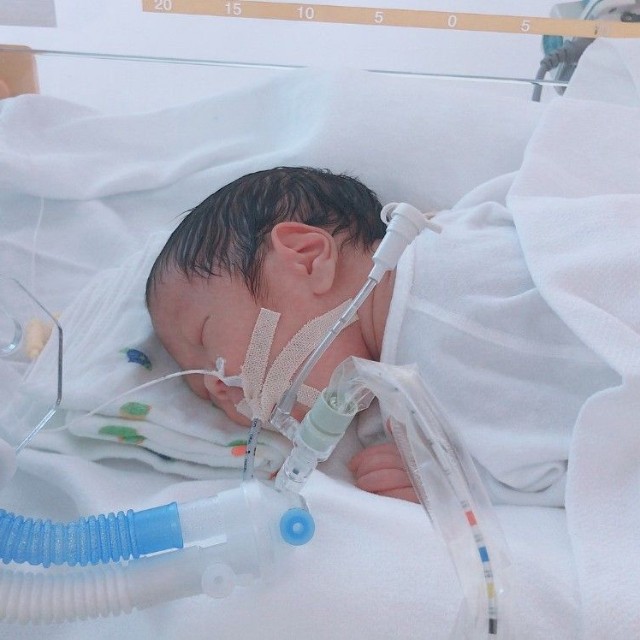 NICUから戻ってくると、口には呼吸器が入れられていた