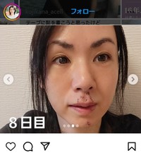 小島可奈子のインスタグラム＠kojikana_acellより