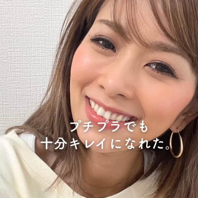 現在、年月を経て、より魅力を増した姿／ろみさん（@romiiiy_beauty）提供