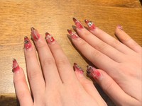 ネイルをレントゲンで撮影すると…。