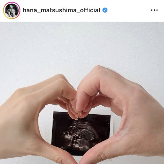 松島花インスタグラム＠hana_matsushima_officialより