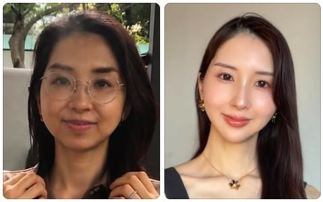 Ayuさんが公開したビフォーアフター写真