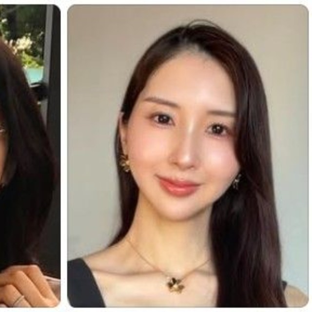 Ayuさんが公開したビフォーアフター写真