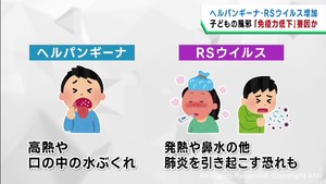 ヘルパンギーナやＲＳウイルスが増加　新型コロナで子どもの免疫力が低下か　長崎大学大学院 森内浩幸教授