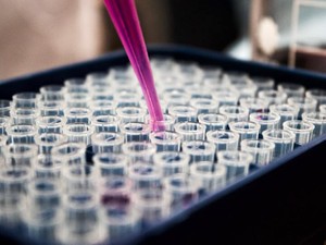 発達障害のある私が脳の研究者を志した。実験が苦手で迷惑ばかりかけて…