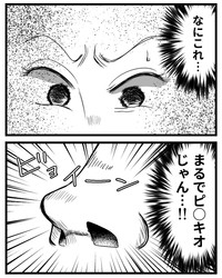 【漫画】『鼻整形したら直美（ちょくび）の医師にバカにされた話』13（うみの韻花さん提供）