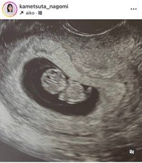 亀蔦なごみアナのインスタグラム＠kametsuta_nagomiより