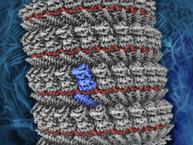 世界を震撼させたエボラ出血熱 – 「見えない敵」との闘いに挑む：朝日