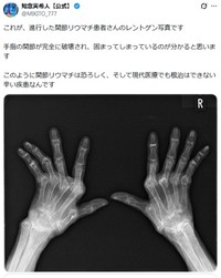 知念実希人氏のX(旧ツイッター)＠MIKITO_777より