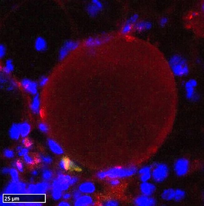 Scientists apply genome editing to treat muscular dystrophy