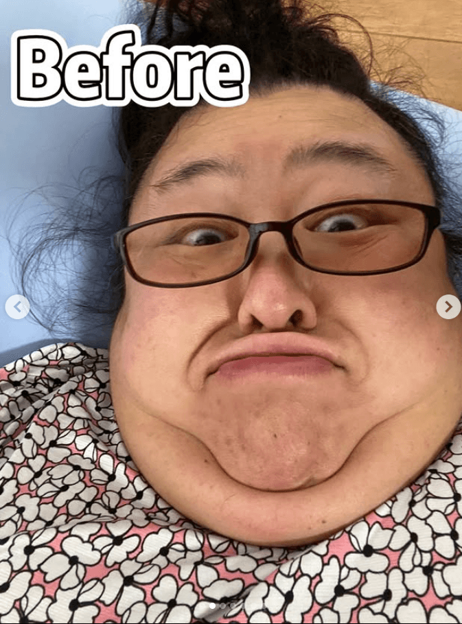 120kg時代のMISAさん 画像提供：ＭＩＳＡさん