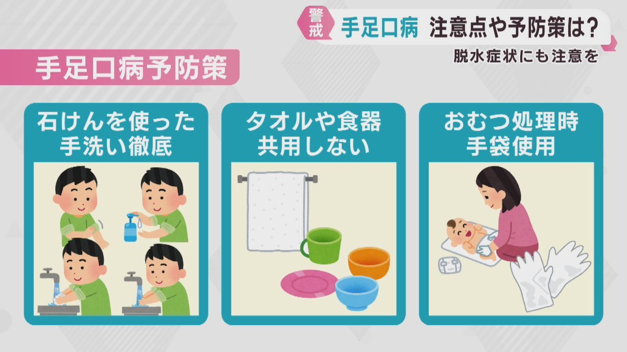 感染者が合増える手足口病　注意点や予防策を医師に聞く