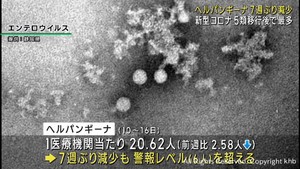 ヘルパンギーナは減少　新型コロナは増加　宮城県の感染者