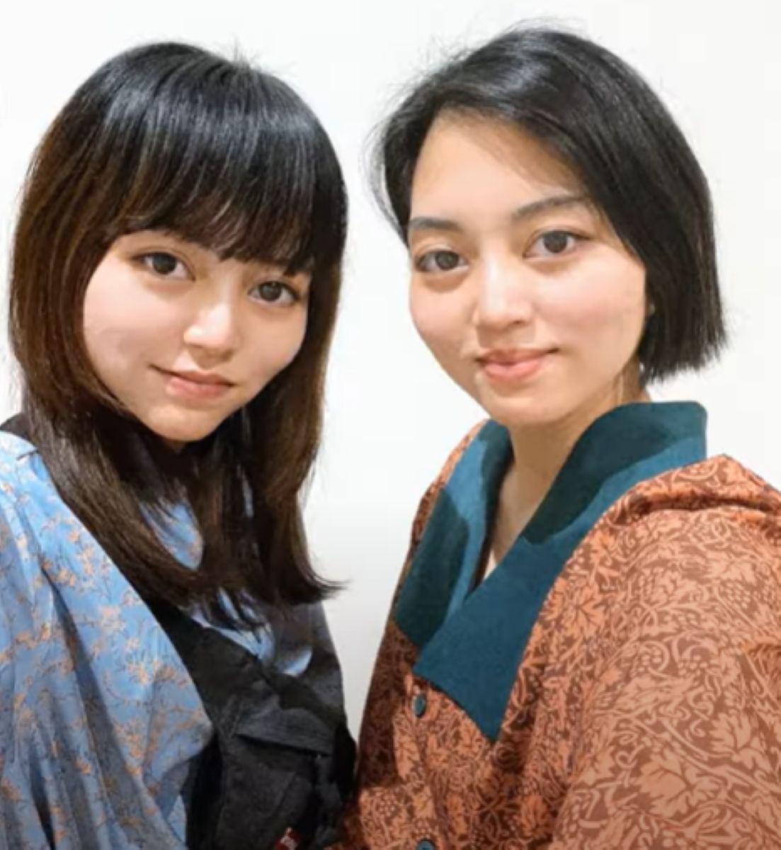 お腹がつながって生まれた双子姉妹 生後2カ月で分離手術 16年後の同じ
