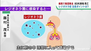 「一気に重症化」レジオネラ症に注意　東北医科薬科大学藤村茂教授