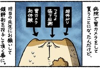 胃カメラの際に鎮静剤を投与することに（ゆうさん提供）