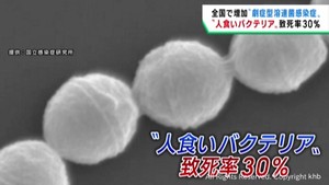 溶連菌咽頭炎　宮城・仙南地域で警報レベル続く　「人食いバクテリア」専門家に聞く危険性