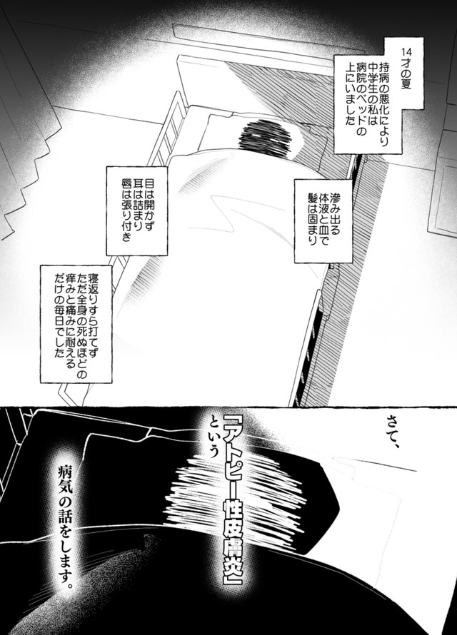 【漫画】『最重度のアトピーだった私が、人権を金で買った話』1（ユイザキカズヤさん提供）