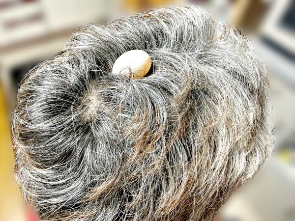 パパの頭の上に産み落とされたリンちゃんの卵（画像提供：ぽぅぽぅのいる世界さん）