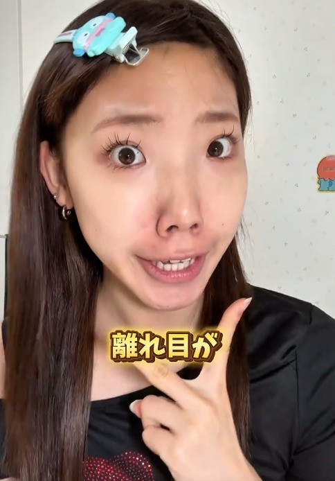 ＜ビフォー＞離れ目がコンプレックスだと語る、まりあさん／まりあさん（@maria_desutte）提供