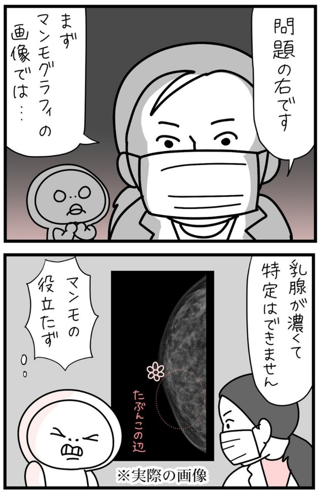 【漫画】『しろめちゃん・45歳・シンママ乳がん列伝』26（しろめちゃんさん提供）