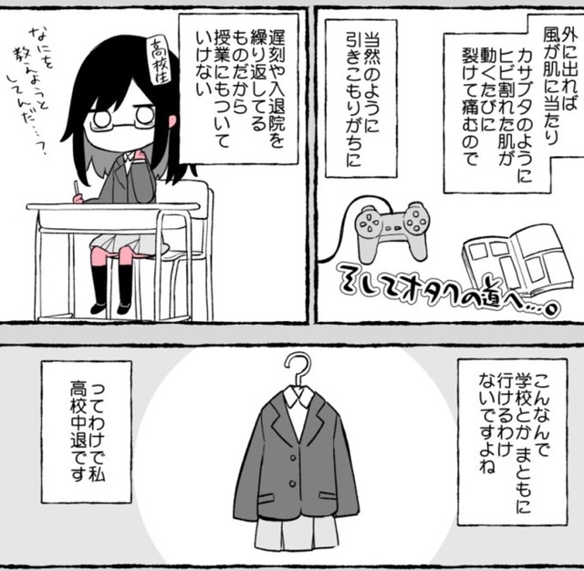 学校生活もアトピーによって楽しめなかった（ユイザキカズヤさん提供）