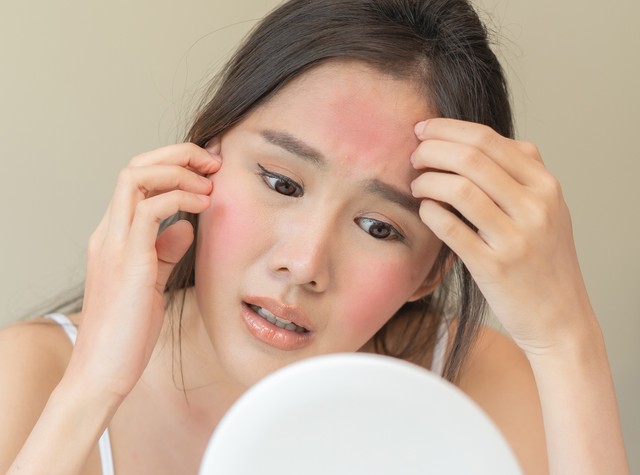 アレルギーにはどんな種類があるのでしょうか　※画像はイメージです（Pormezz/stock.adobe.com）