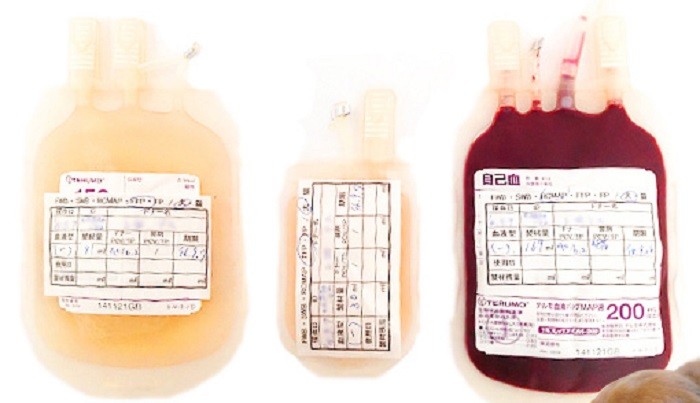 ドナー犬からもらった血液は、病院内で製剤化し、必要なときに備えて保管している（ぬのかわ犬猫病院提供）