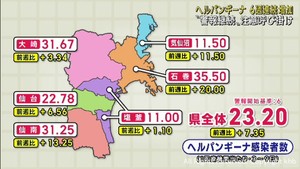 ヘルパンギーナ　宮城県で感染者が６週連続で増加