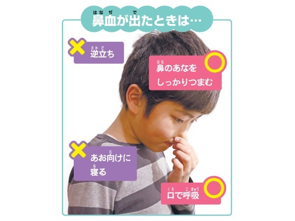 鼻血』にまつわる素朴な疑問 子どもの鼻血の正しい対処法も