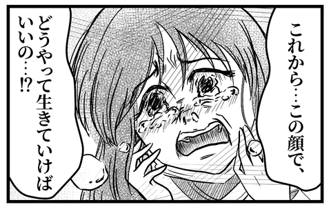 まさかの整形失敗…どうする？（うみの韻花さん提供）